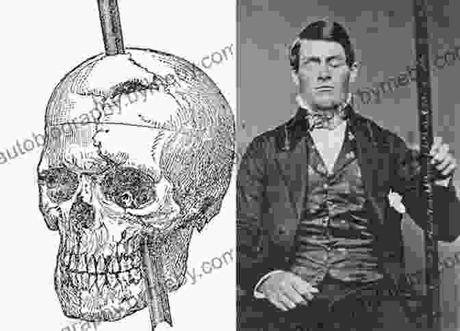 Phineas Gage, A Railroad Worker Who Survived A Metal Rod Through His Brain, Demonstrating The Brain's Remarkable Plasticity The DisFree Downloaded Mind: What Unusual Brains Tell Us About Ourselves